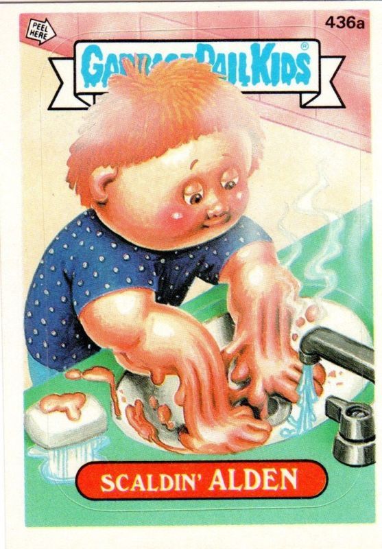 Garbage Pail Kids SERIES 11 SCALDIN ALDEN 436A  